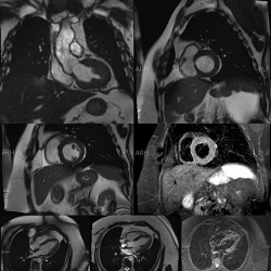 ام آر آی قلب - مطب دکتر آزاده داودیان بروجن