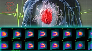 اسکن هسته ای قلب - مطب دکتر آزاده داودیان بروجن